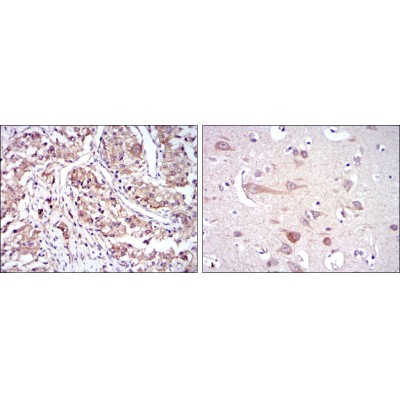 Валидация Affinity BF0215 - 5178