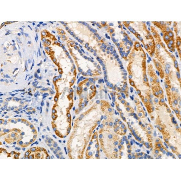 Валидация Affinity DF3695 - 14720