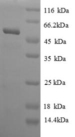 SDS-PAGE