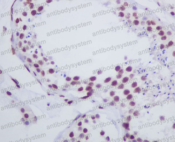 Валидация AntibodySystem RHC24302