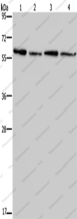 Вестерн-блоттинг, CD297, ткани почки, печени, сердца и мозга мыши