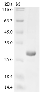 SDS-PAGE