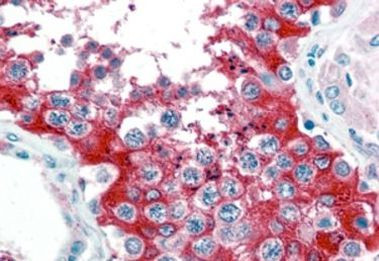 Валидация AssayVector ARM2611(4773)