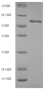 SDS-PAGE