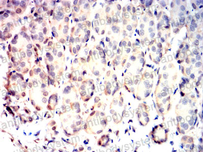 Валидация AntibodySystem RHC09001 (609)