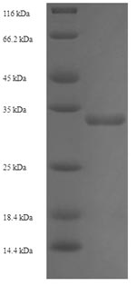 SDS-PAGE