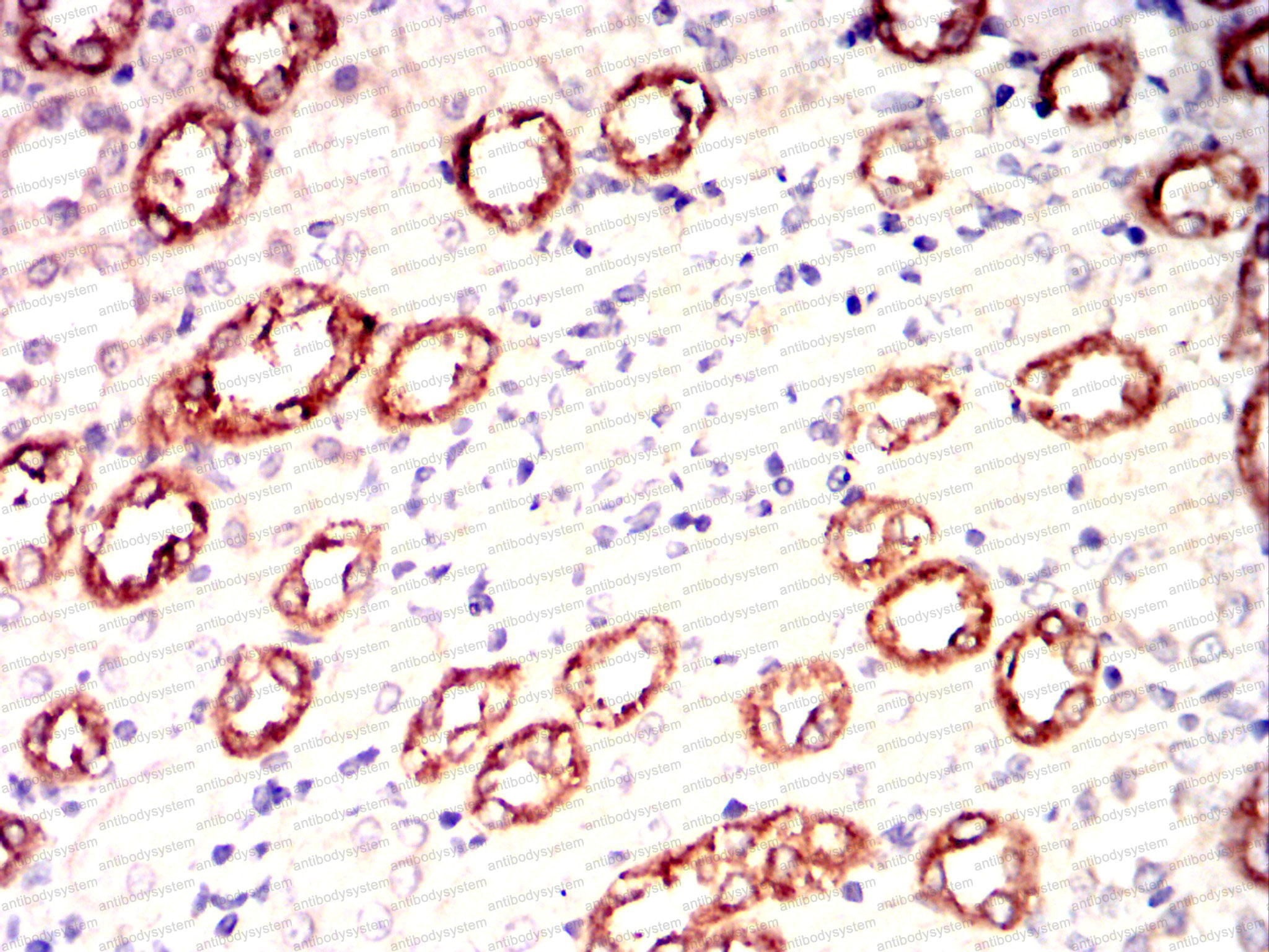 Валидация AntibodySystem RHC84902 (1116)