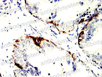 Валидация AntibodySystem RHB98006