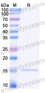 Валидация SDS-PAGE - AntibodySystem RZZ01819