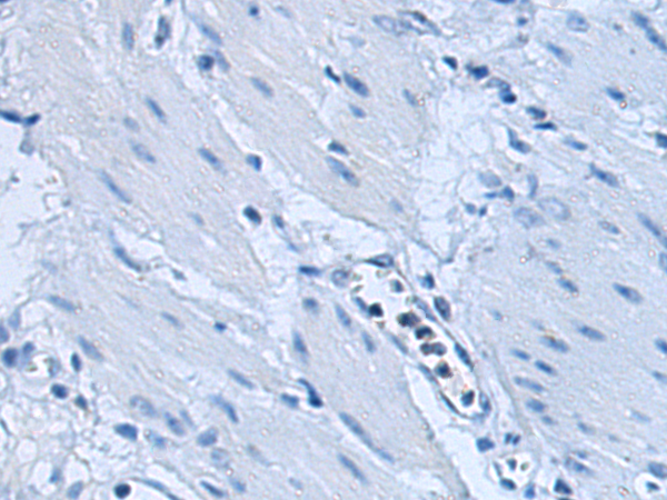 Валидация AssayVector ARM1741(2108)