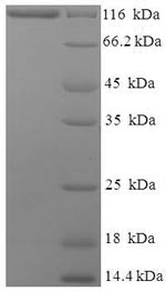 SDS-PAGE