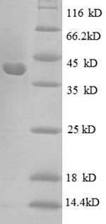 SDS-PAGE