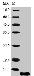 SDS-PAGE