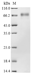 SDS-PAGE