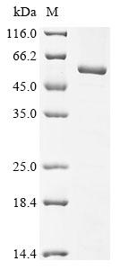 SDS-PAGE