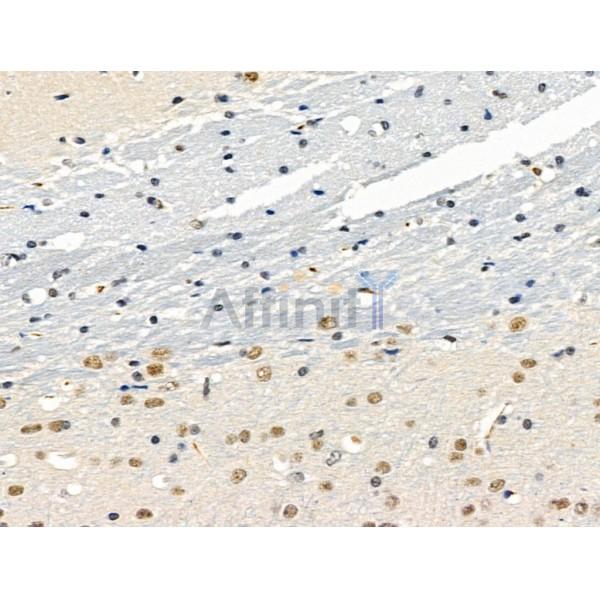 Валидация Affinity DF13657 - 9218