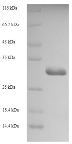 SDS-PAGE