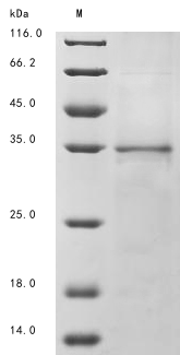 SDS-PAGE