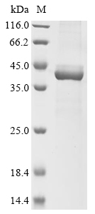 SDS-PAGE