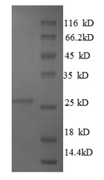 SDS-PAGE