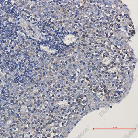 Иммуногистохимия, alpha Tubulin, ткань миндалин человека