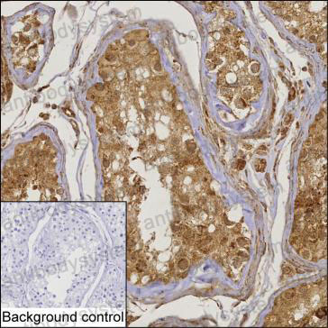 Валидация AntibodySystem RHN87202