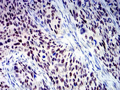 Валидация AntibodySystem RHN97002