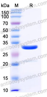 AHJ92802, SDS-PAGE