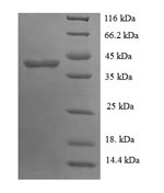 SDS-PAGE