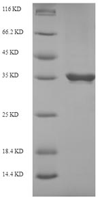 SDS-PAGE