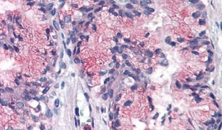 Валидация AssayVector ARM1214(571)