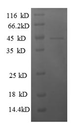 SDS-PAGE