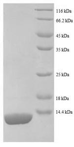 SDS-PAGE