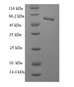 SDS-PAGE