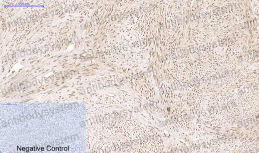 Валидация AntibodySystem RHC33013 (890)