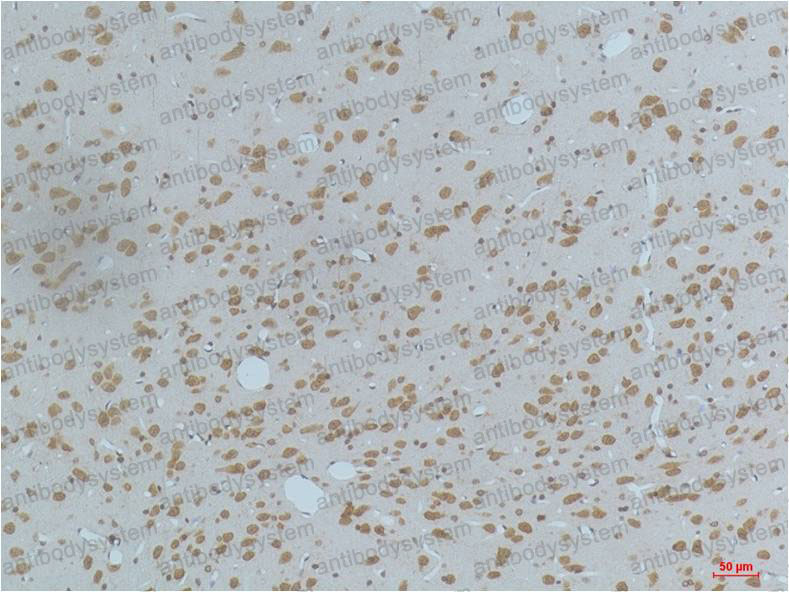 Валидация AntibodySystem RHG58302 (3010)