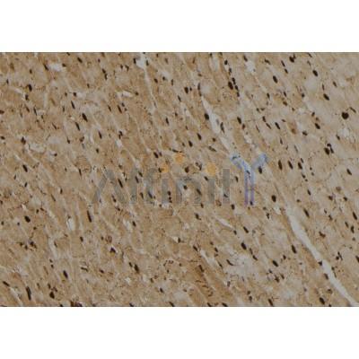 Валидация Affinity DF2925 - 13662