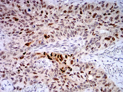 Валидация AntibodySystem RHH07201 (3155)