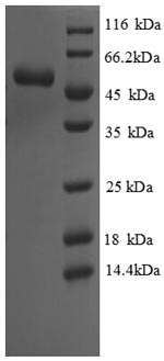 SDS-PAGE