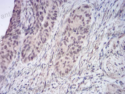 Валидация AntibodySystem RHJ33003