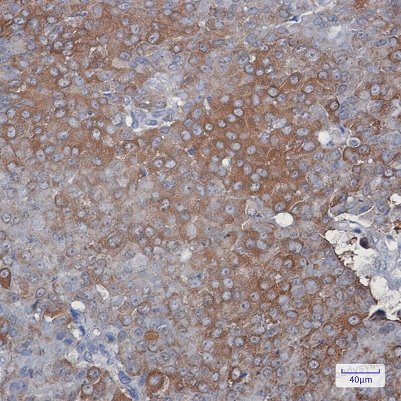 Валидация AntibodySystem RHD98403