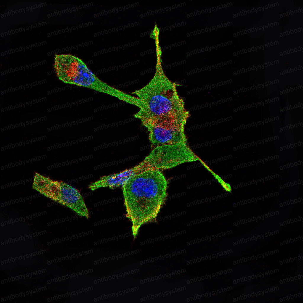 Валидация IF - AntibodySystem RHF36801 (1004)