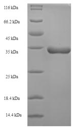 SDS-PAGE