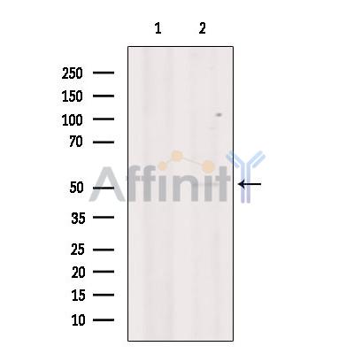 Валидация Affinity DF6156 - 17392
