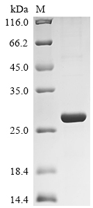SDS-PAGE