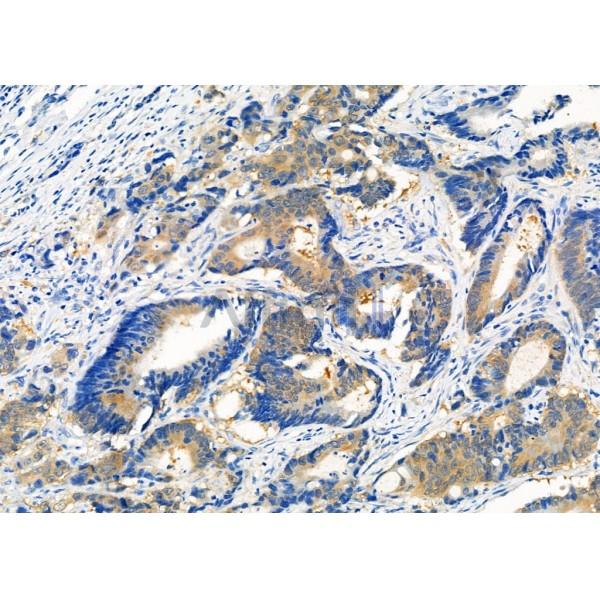 Валидация Affinity DF6842 - 18414