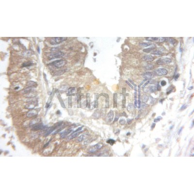 Валидация Affinity AF6097 - 3303