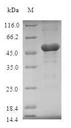 SDS-PAGE