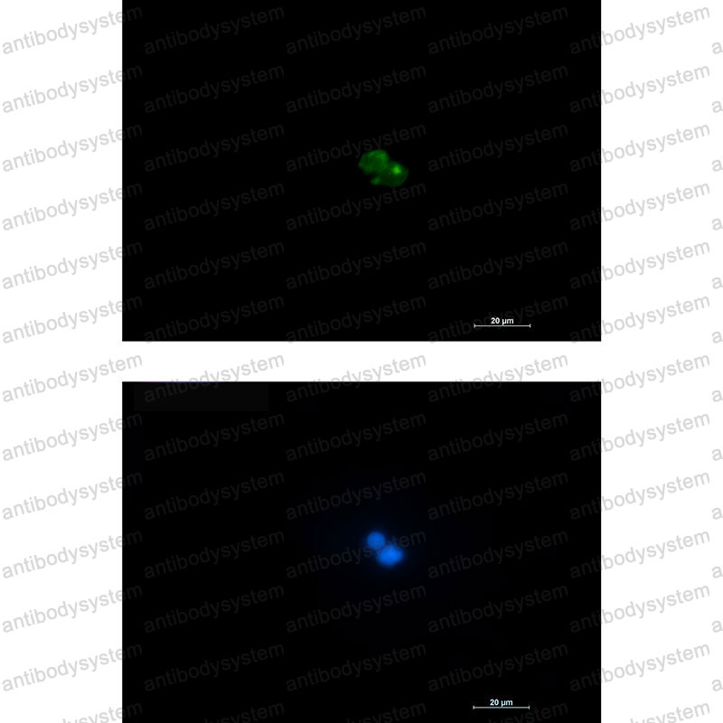 Валидация IF - AntibodySystem RHC41802