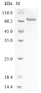 SDS-PAGE